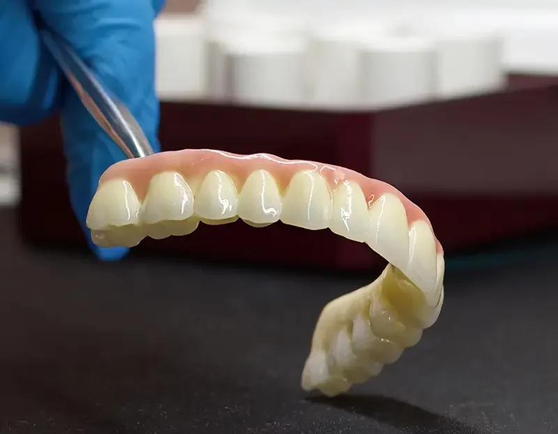 Zahnersatz-Leistungsbild